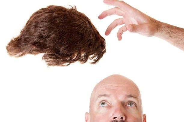 what is monofilament wigs Explained with Styling Tips, Pros, Benefits and Care Advice